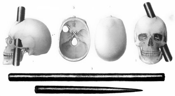 Czaszka Phineasa Gage'a z prętem ubijającym